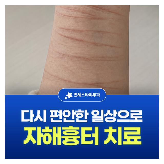 자해흉터 치료, 다시 편안한 일상으로 돌아갈 수 있도록 돕겠습니다